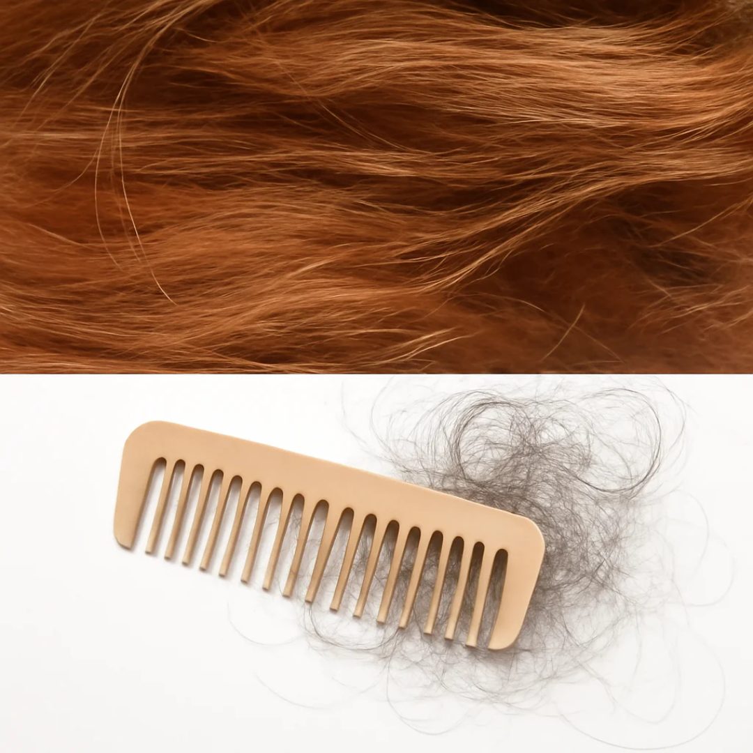 Caida de Cabello
